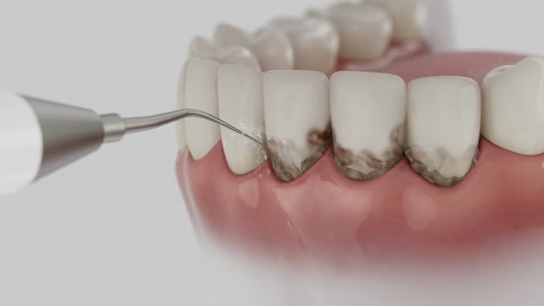 Reliable Teeth Cleaning And Checkup contractor in Martin County County, IN by Dentist Open Now